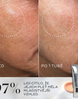 Medik8 Crystal Retinal®