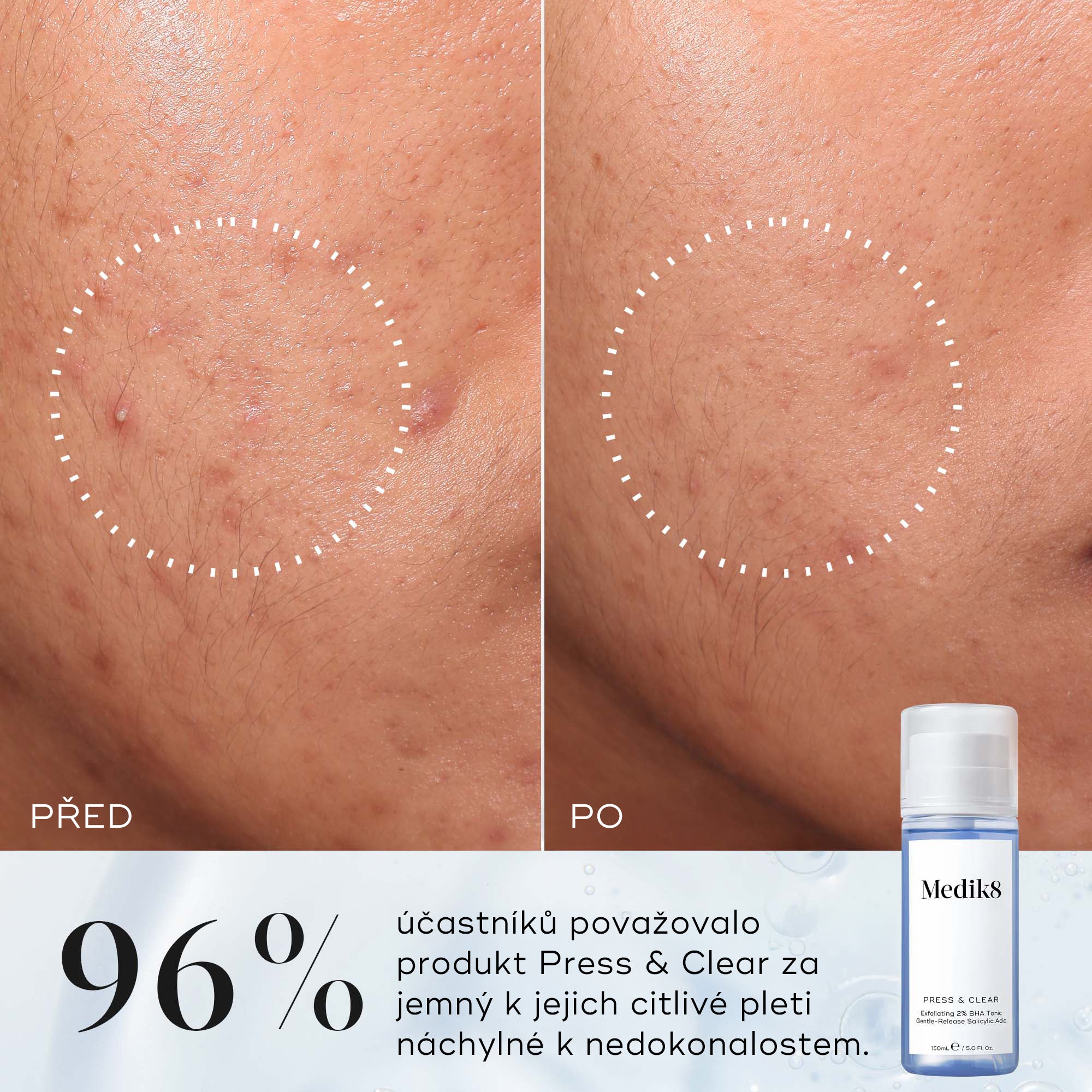 Medik8 Press & Clear™