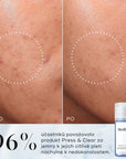 Medik8 Press & Clear™