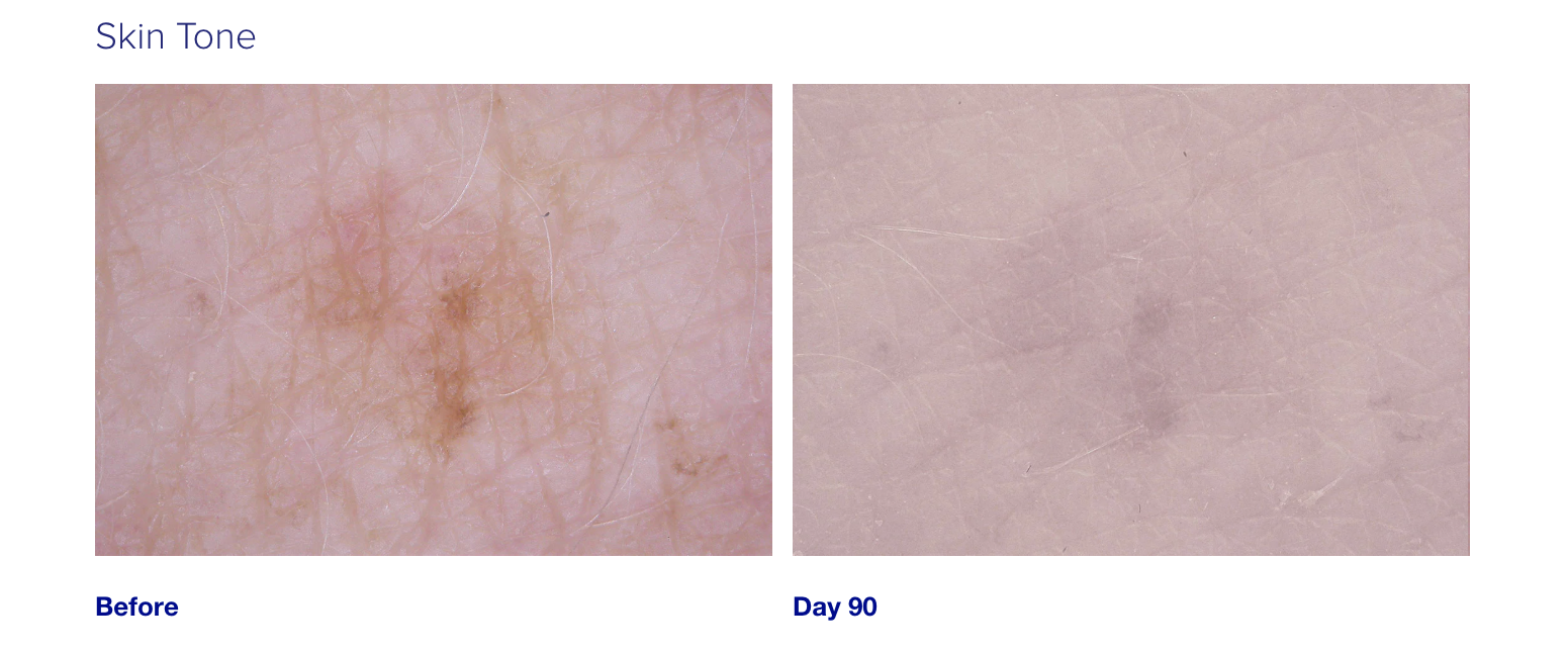 iSClinical Brightening Serum 30 ml