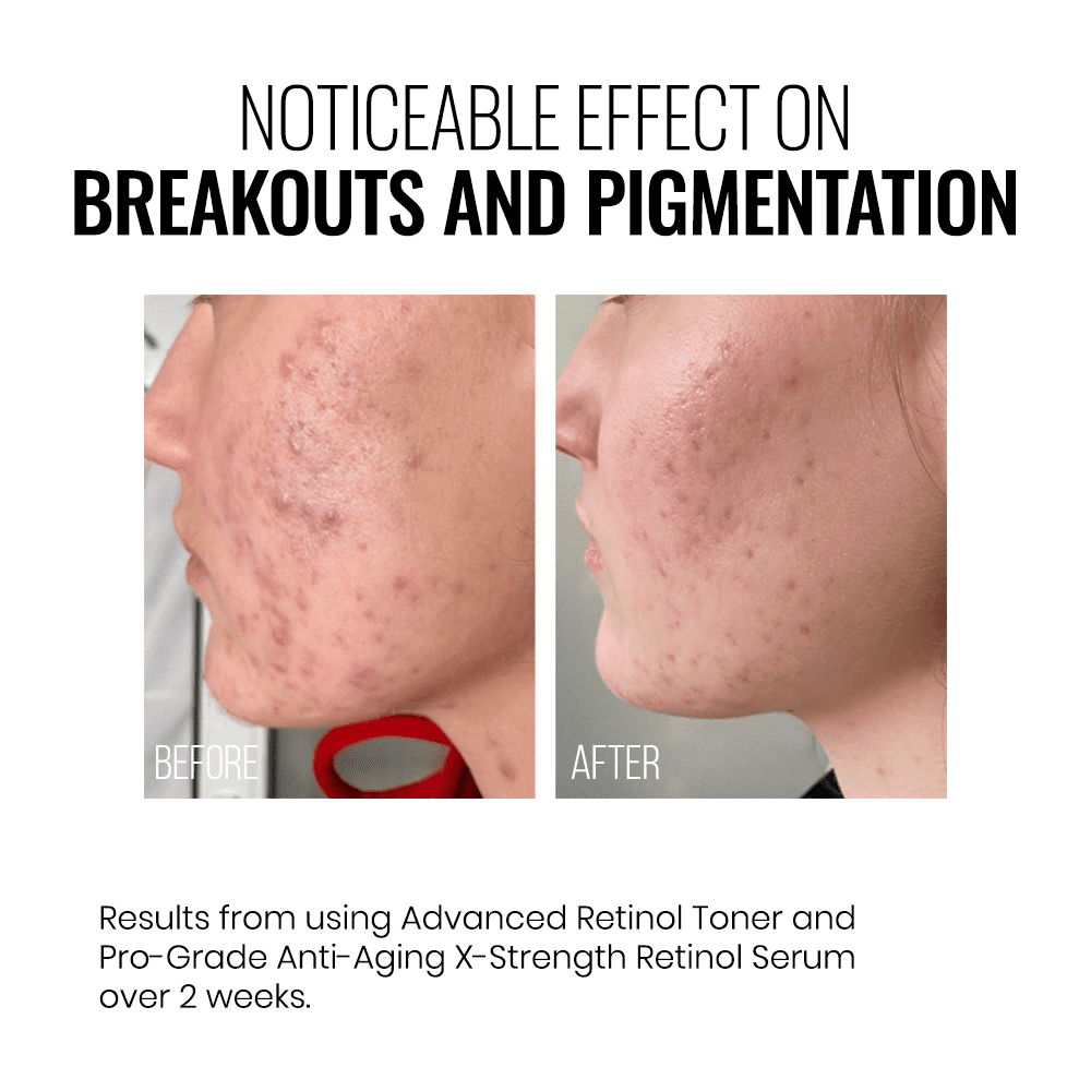 Instytutum A-Superpacked X-strength Retinol Serum 30ml
