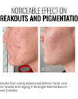 Instytutum A-Superpacked X-strength Retinol Serum 30ml