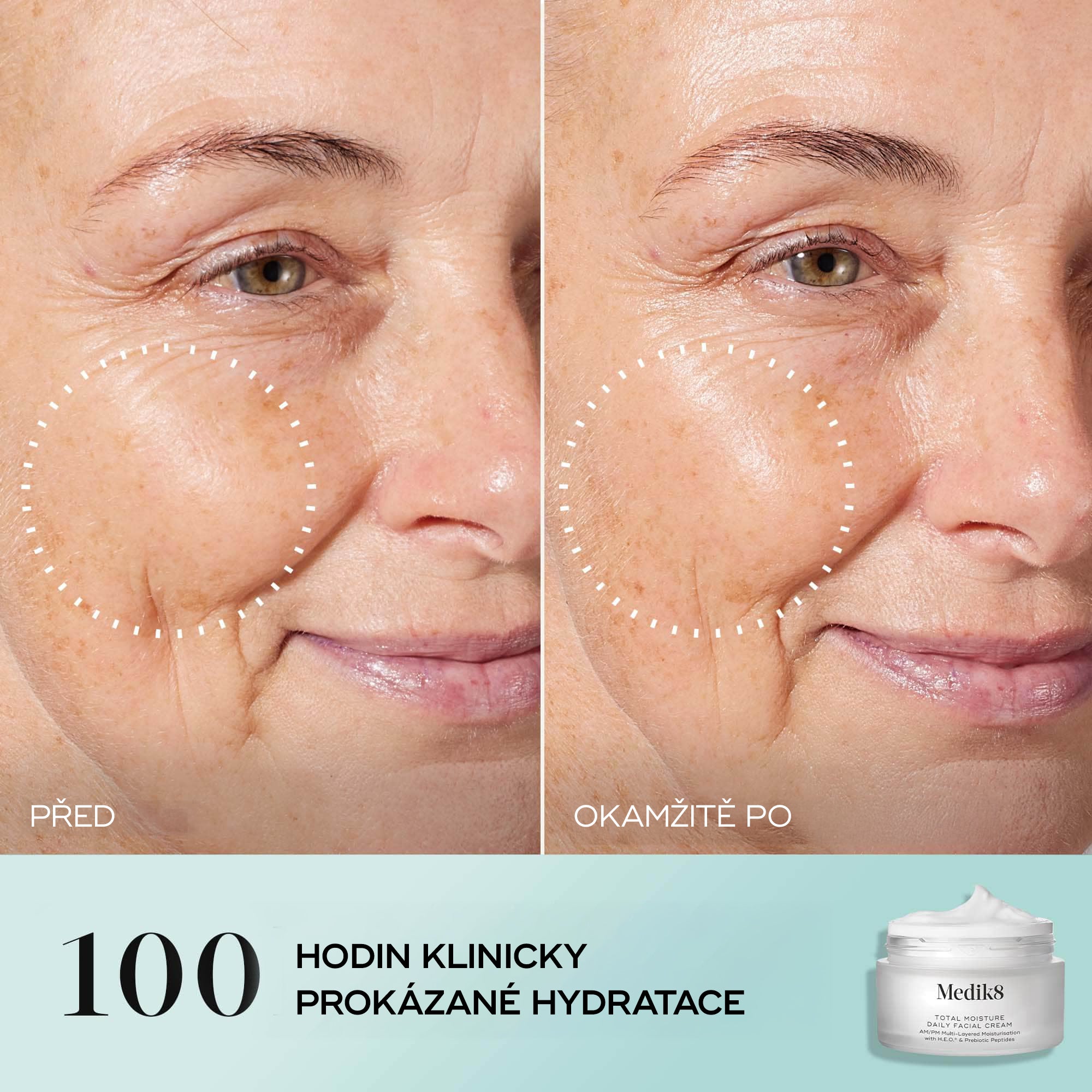 Medik8 Total Moisture Daily Facial Cream™