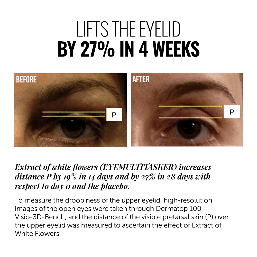 Comparison image showing eyelid lift results before and after using EYE MULTITASKER serum, with 27% improvement in 4 weeks.